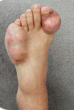 LOVILDS® Bee Venom Bone Care Cream LOVILDS® Bee Venom Bone Care Cream