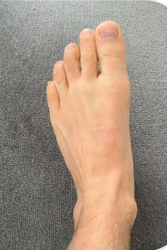 LOVILDS® Bee Venom Bone Care Cream LOVILDS® Bee Venom Bone Care Cream