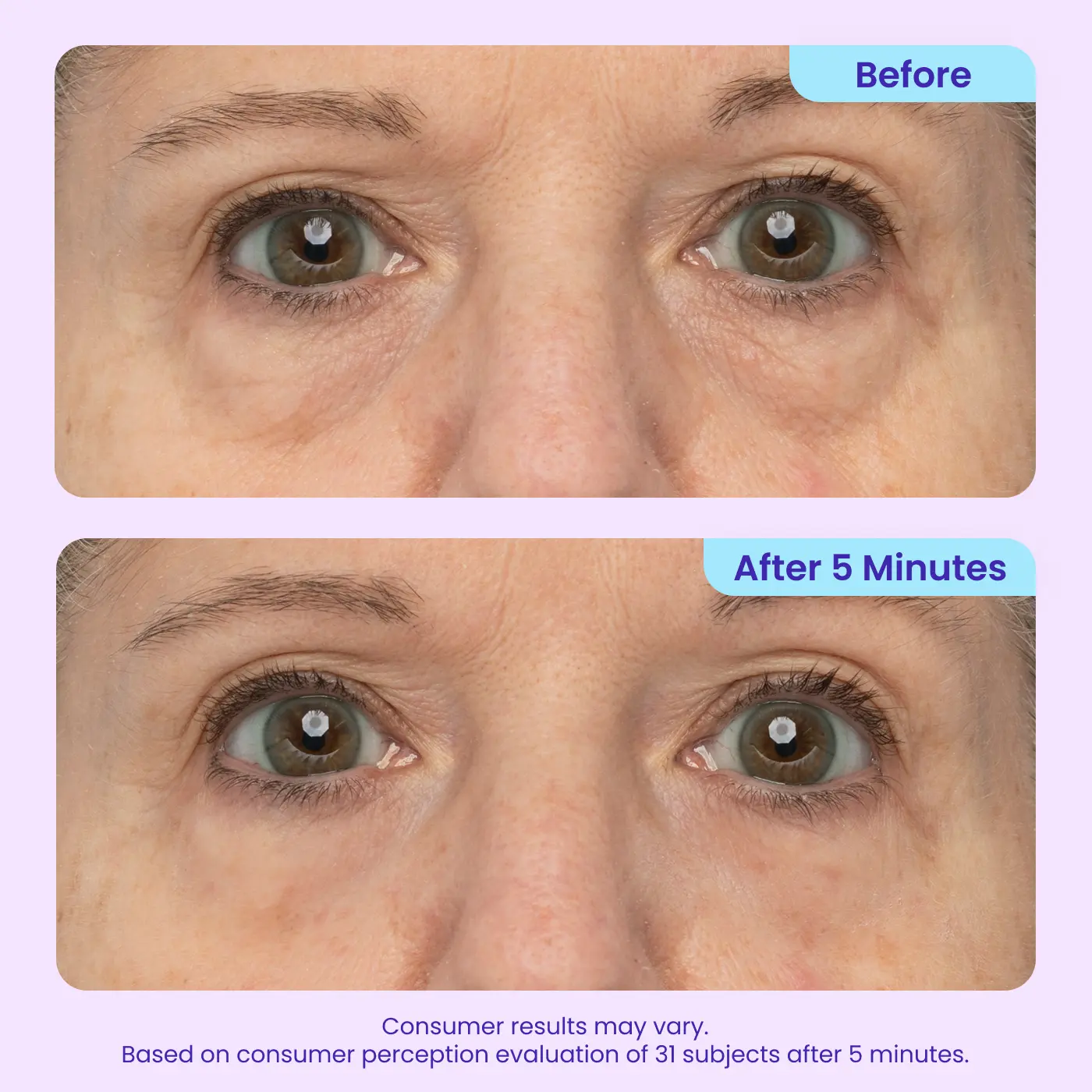 NEW! Instant Lift Eye Gel — Reduce the Look of Eye Bags in Minutes