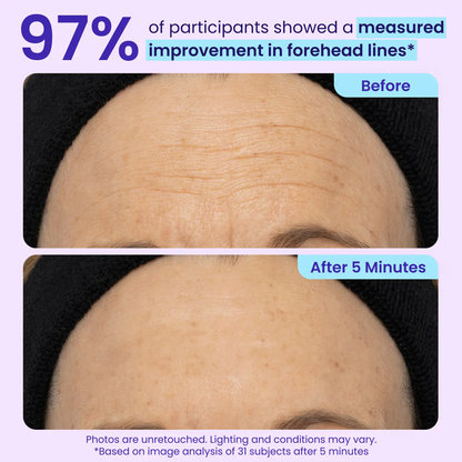 NEW! Instant Lift Eye Gel — Reduce the Look of Eye Bags in Minutes