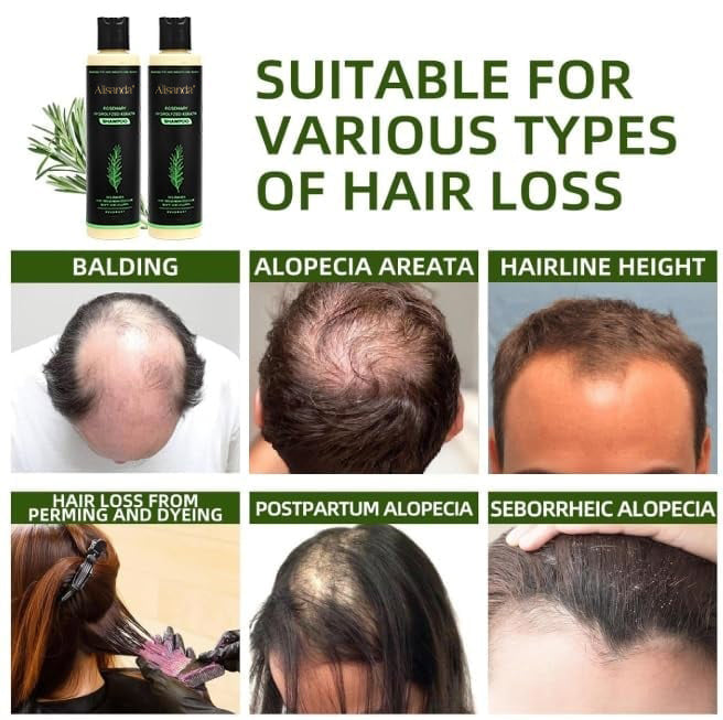 🔥LAST DAY 50% OFF🔥Alisanda® Organic Rosemary Hair Growth Shampoo