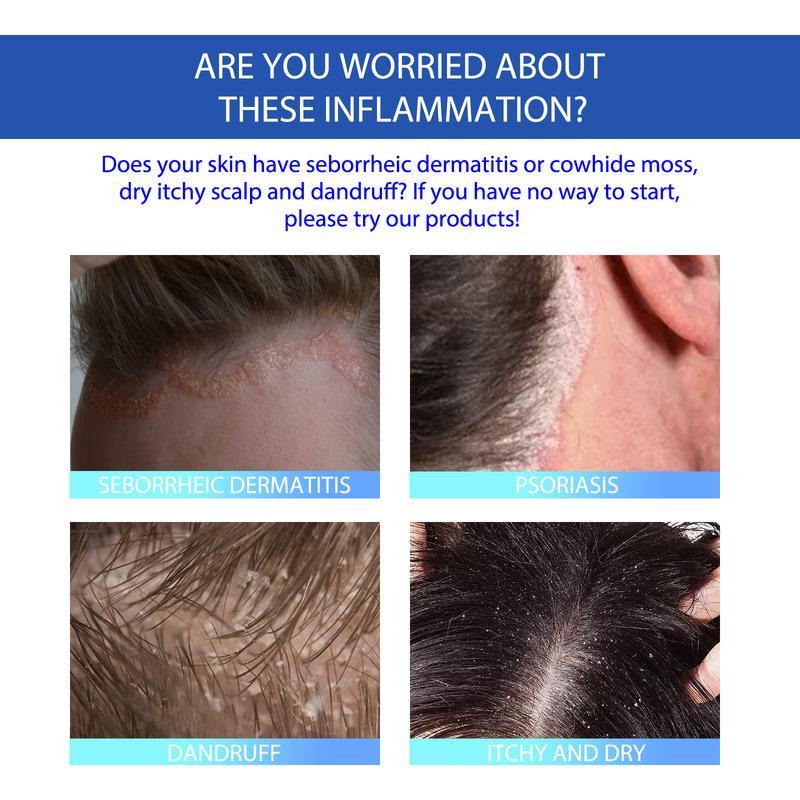 🔥LAST DAY 80% OFF🔥Alisanda Folliculitis Treatment Cream