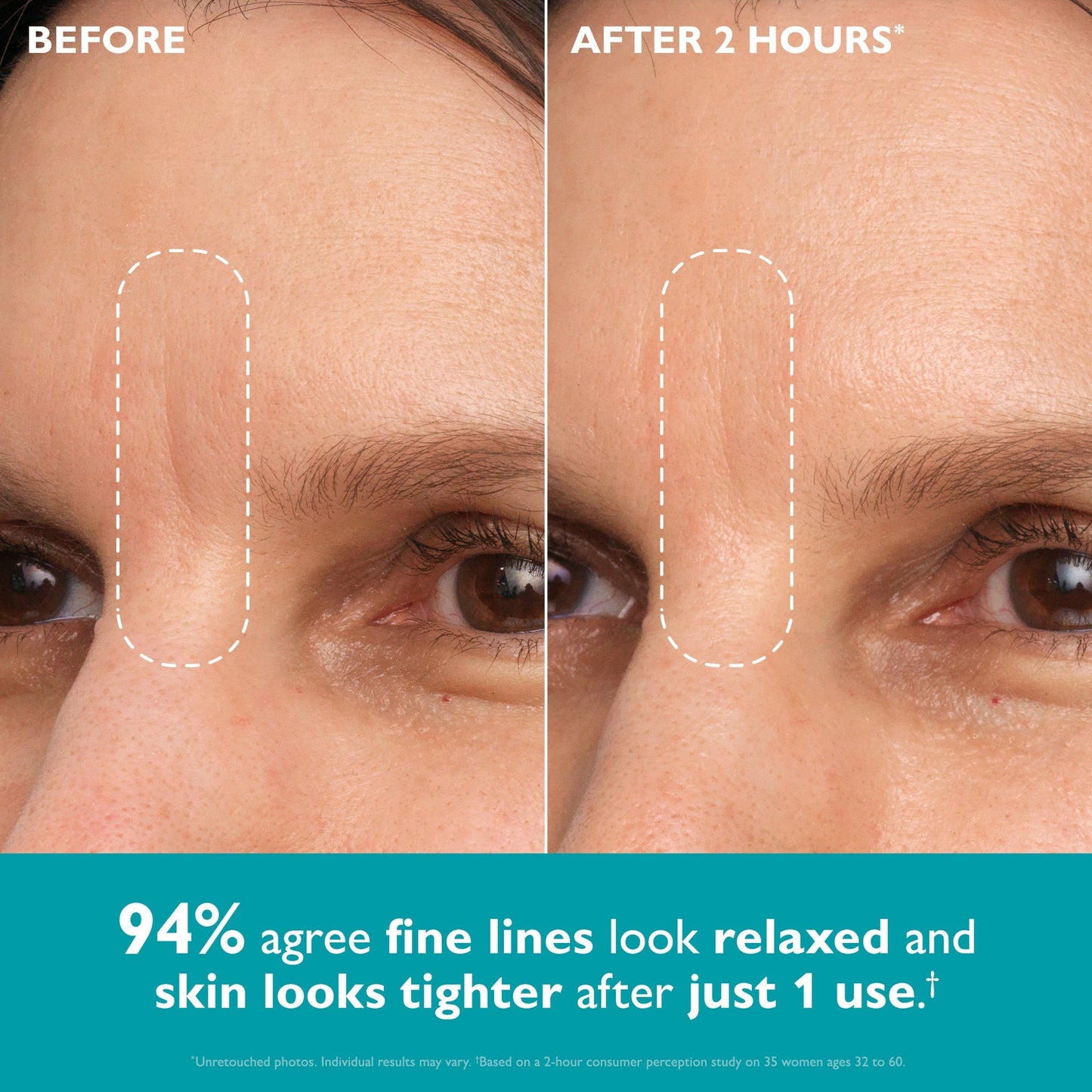 Peptide-Infused Face & Eye Tape-