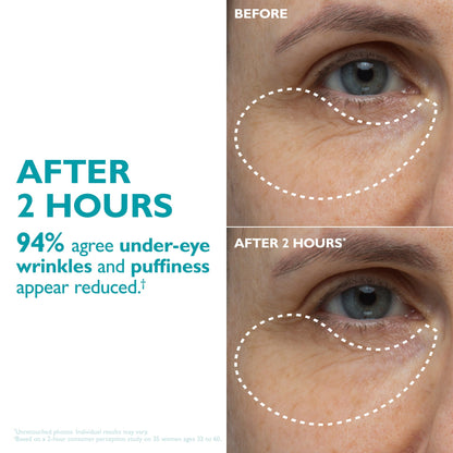Peptide-Infused Face & Eye Tape-